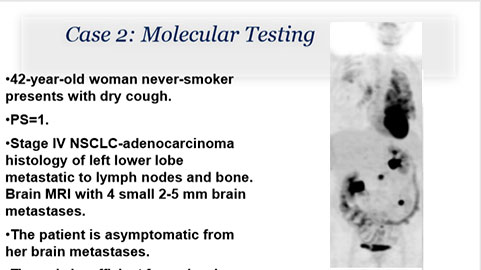 Case Study Molecular Testing