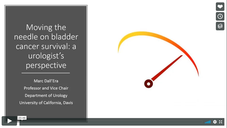 Moving the Needle on Bladder Cancer Survival: A Urologist's Perspective